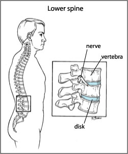 The Skinny On: Your Lower Back